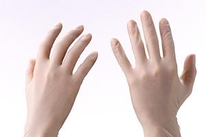 2025年最新！宇都宮で歯並び改善を成功させるための最適な対策と専門的アドバイス